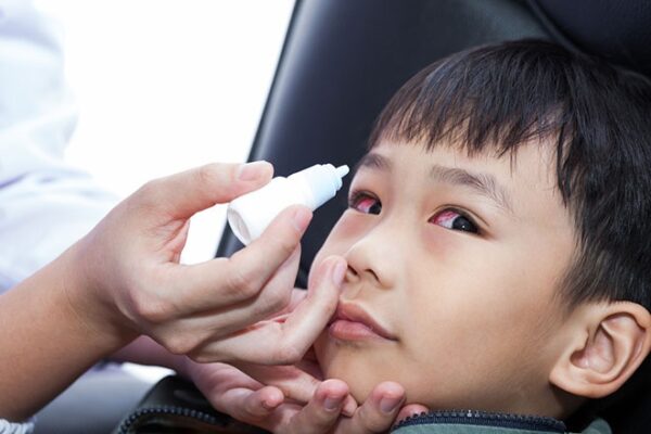 bị đau mắt đỏ
