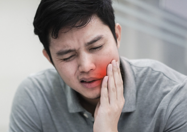 cao răng cấp độ 3