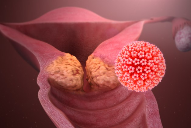 virus hpv là gì
