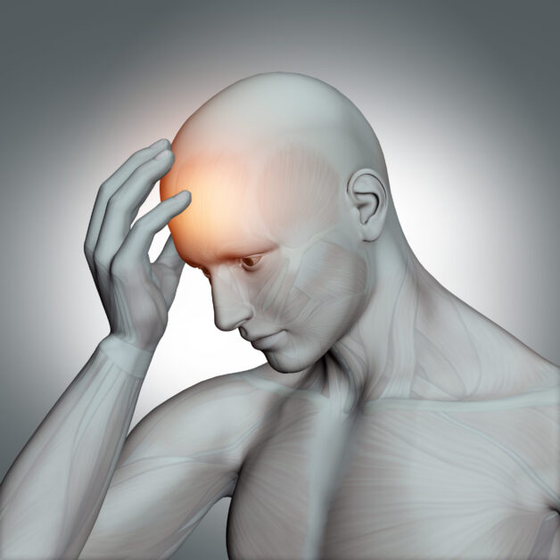 Đột quỵ não gây rất nhiều hậu quả nghiêm trọng