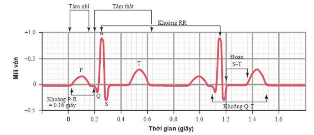 Điện tâm đồ bình thường thể hiện qua các chỉ số