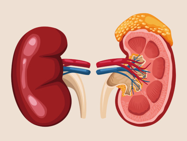 Suy tuyến thượng thận cấp là một trong những dạng rối loạn hiếm gặp.