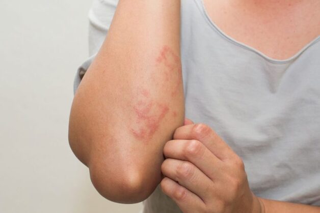 Ngay khi xuất hiện triệu chứng cảnh báo, người bệnh cần thăm khám để xác định gan nhiễm mỡ hay không