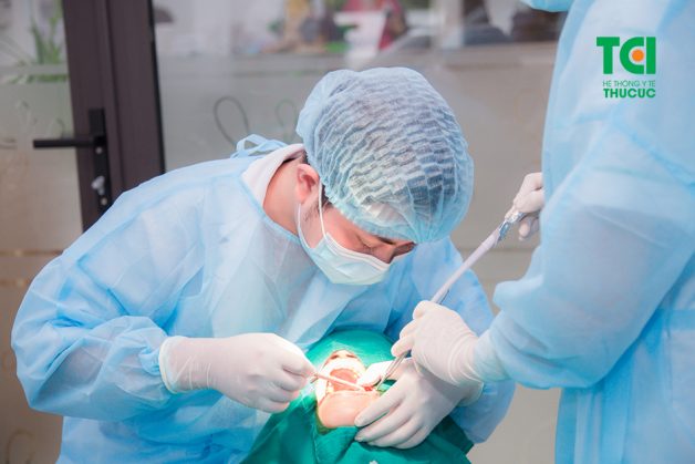 giá cấy ghép implant
