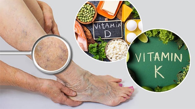 mất ngủ buồn bực chân tay do thiếu vitamin