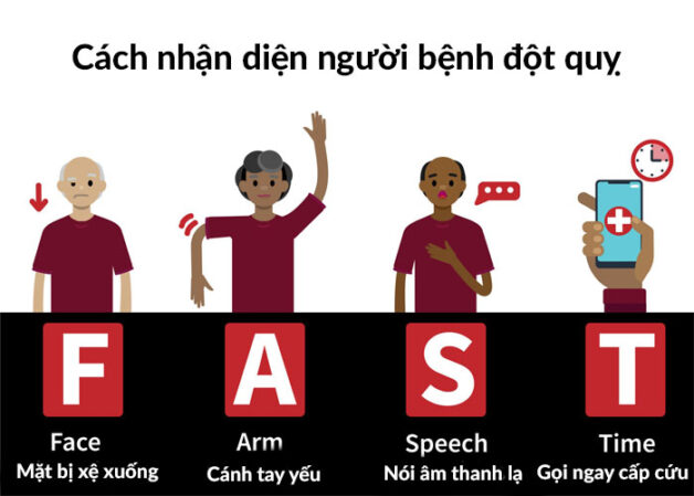 rung nhĩ tăng nguy cơ đột quỵ