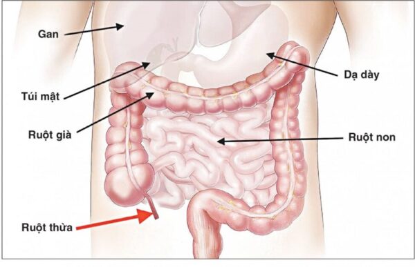 Điều trị viêm ruột non 