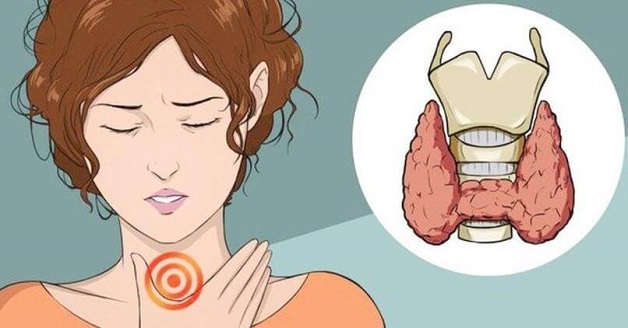 Bệnh viêm tuyến giáp hashimoto