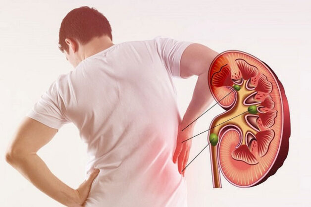 Hình ảnh bệnh nhân suy thận