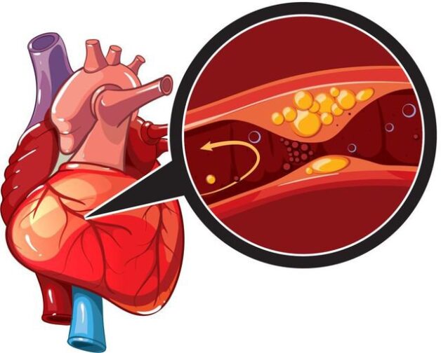 Biến chứng có thể là thiếu máu
