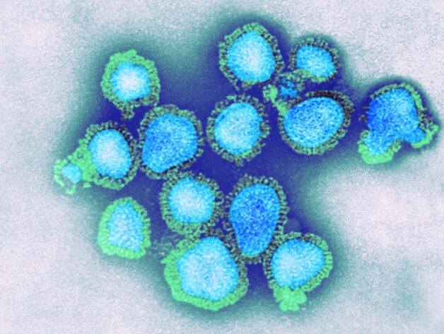 Cúm - một bệnh truyền nhiễm cấp tính đường hô hấp, có nguyên nhân phát sinh là virus Influenza.