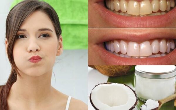 Dùng dầu dừa tự nhiên loại bỏ mảng bám
