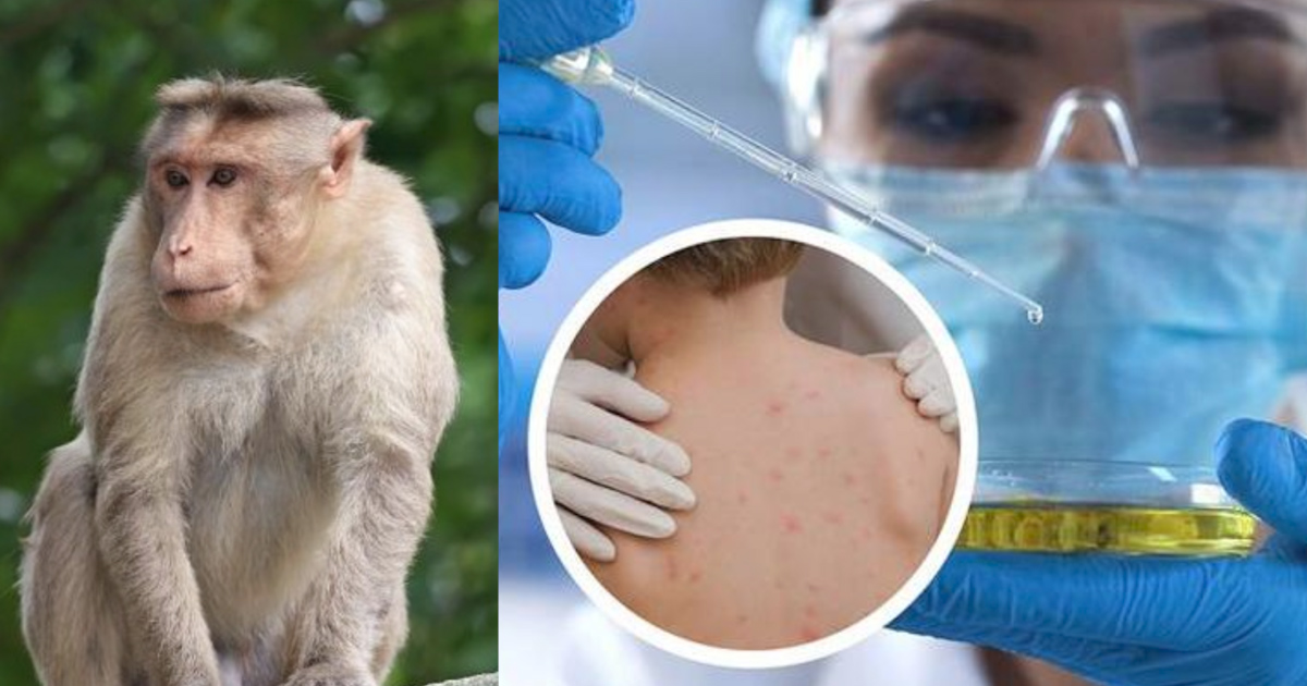 Bệnh đậu mùa khỉ chủ yếu do các động vật hoang dã, linh trưởng mang mầm bệnh và lây nhiễm sang con người