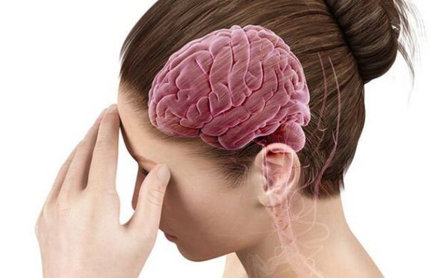 đột quỵ gây ra bệnh Parkinson
