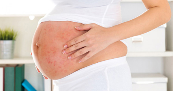 Mẹ bầu bị sốt xuất huyết rồi hoàn toàn có thể bị lại