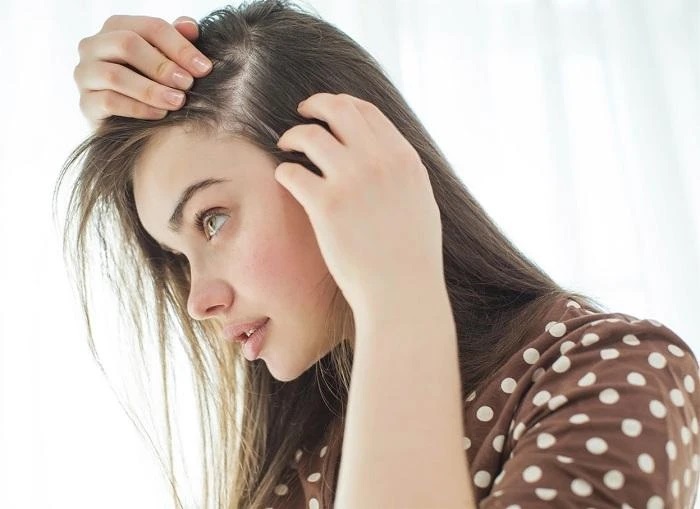 Nguyên nhân chính của hiện tượng rụng tóc sau khi khỏi bệnh sốt xuất huyết là do chất dinh dưỡng cung cấp đến chân tóc không đủ