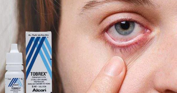 thuốc đau mắt đỏ tobrex dùng cho phụ nữ có thai 