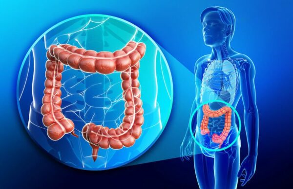 Thuốc xổ là gì?
