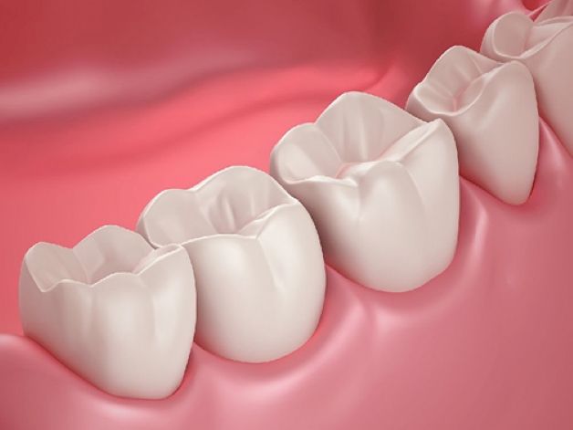 trám răng thẩm mỹ