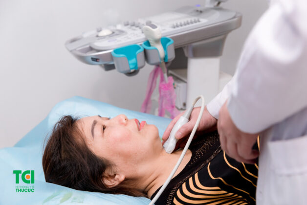 Nhiều trường hợp phát hiện bướu giáp đa nhân sau siêu âm kiểm tra sức khỏe định kỳ.
