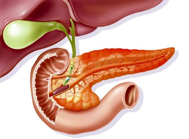 Bị viêm tụy cấp tính hay mạn cũng cần được điều trị sớm, phù hợp, ngăn ngừa biến chứng xảy ra