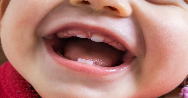 Với trẻ 1 cái răng sữa mọc trong bao lâu?
