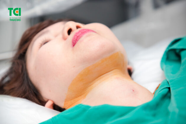Đốt sóng cao tần là phương pháp không để lại sẹo
