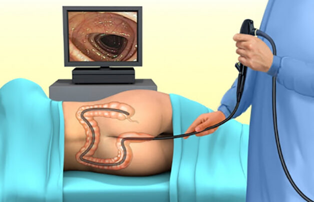 Sử dụng ống nội soi và camera mổ nội soi