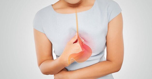 Trào ngược dạ dày thực quản ICD 10 là mã bệnh