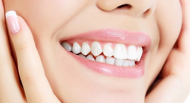 Ưu điểm bọc răng sứ của Đức