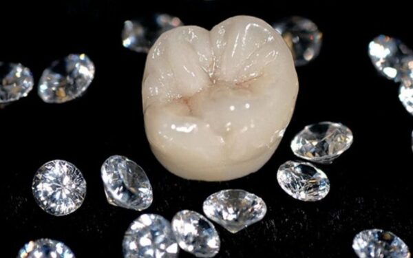 Tìm hiểu về khái niệm của răng sứ Diamond