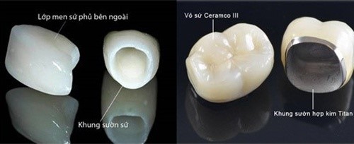 top 5 mão răng sứ cực đẹp-2