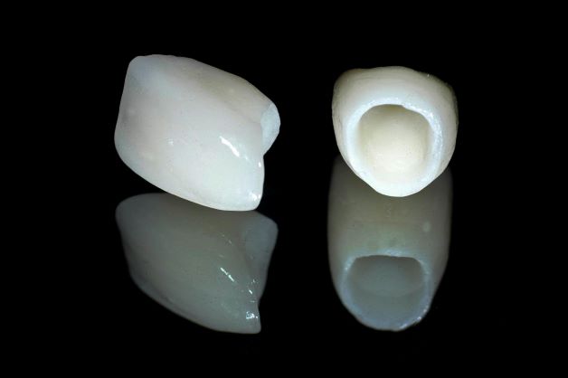 Mão toàn sứ được cấu tạo hoàn toàn từ vật liệu bằng sứ