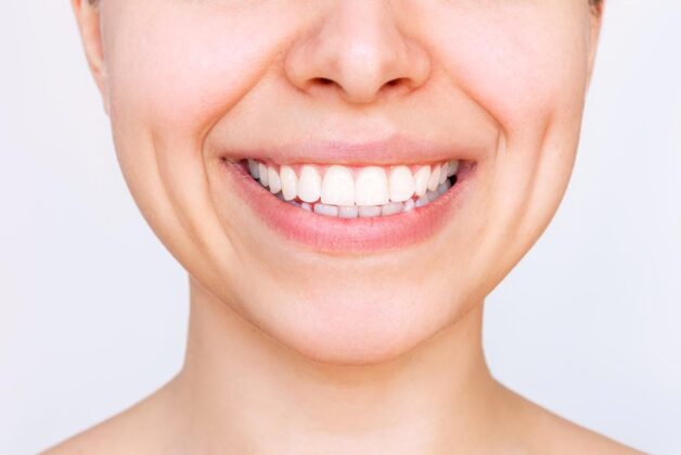 Bọc răng sứ xong có niềng được không?
