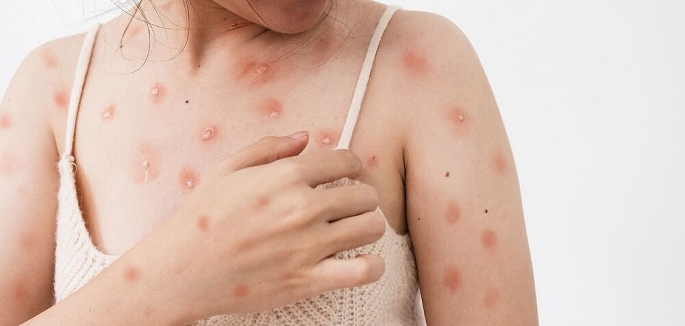 các bệnh khi quan hệ