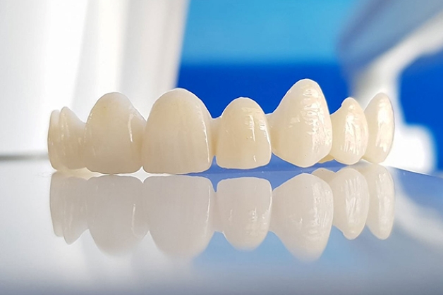 các loại răng sứ cao cấp là gì