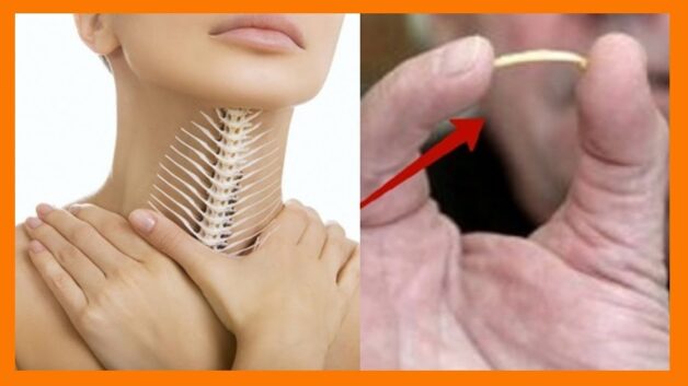 cách chữa hóc xương cá bằng mật ong ra sao