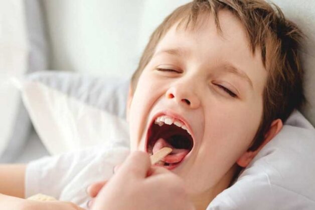 Lấy xương cá đơn giản sau khi kiểm tra tình trạng hóc