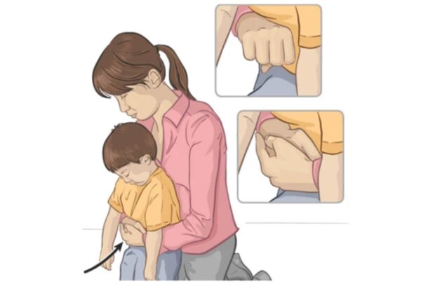 Hình minh họa cách sơ cứu cho trẻ trên 2 tuổi