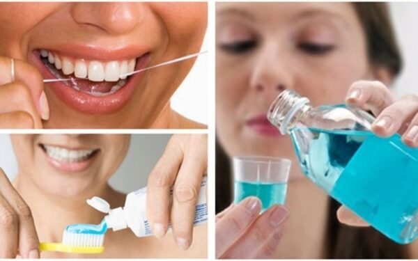 Những lưu ý sau khi thực hiện lấy cao răng