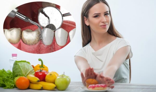 Nên ăn những loại thực phẩm mềm để cảm giác ê răng nhanh biến mất