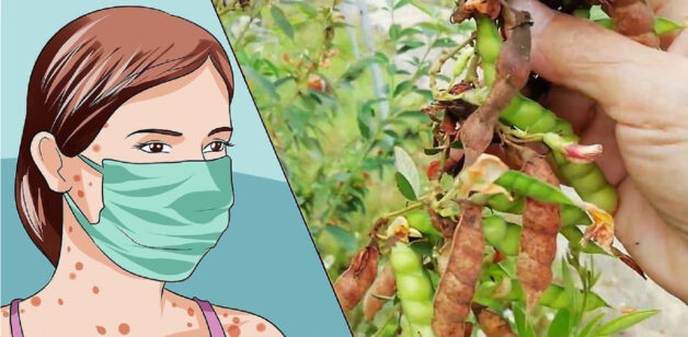 Cây đậu săng chữa bệnh thủy đậu ra sao