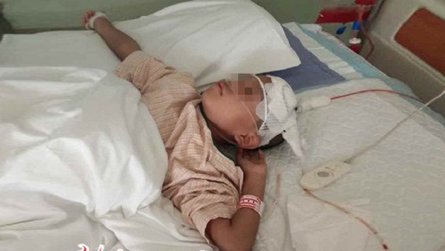 Đột quỵ trẻ em rất nguy hiểm đến tính mạng và sự phát triển sau này của trẻ