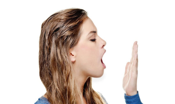 hôi miệng khi niềng răng