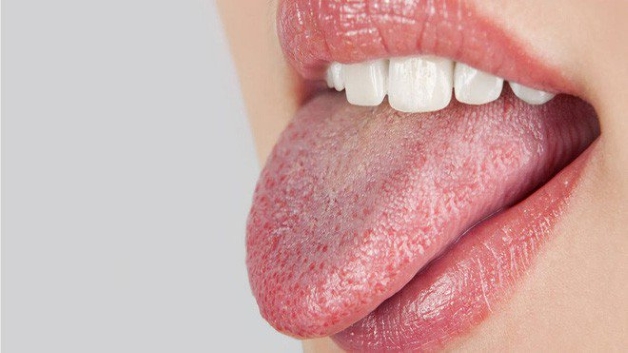 bị hôi miệng khô miệng