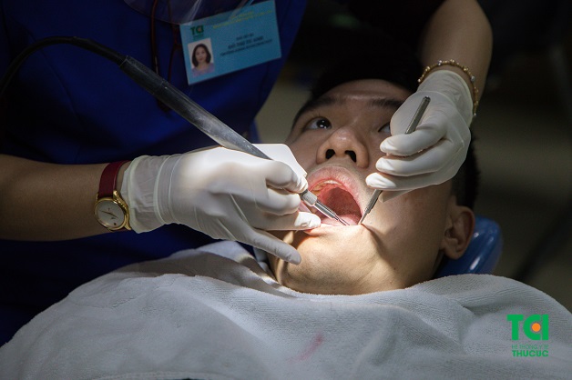 Hình thực tế Lấy cao răng bằng công nghệ mới