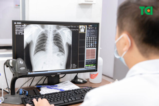 Chụp X-quang có ý nghĩa lớn trong chẩn đoán, tìm ra nguyên nhân gây bệnh lao