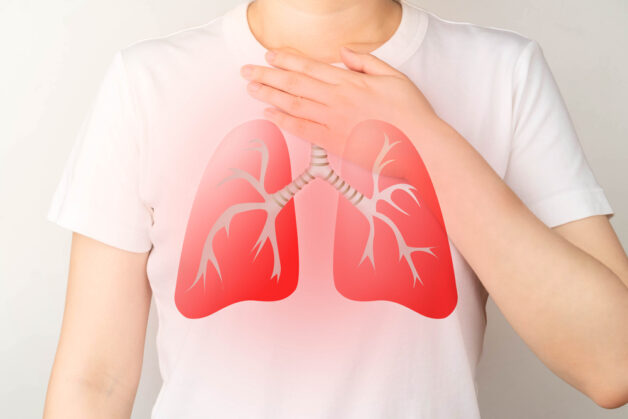 Nguyên nhân viêm phế quản cấp thường do virus, vi khuẩn
