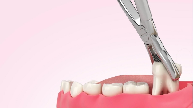 nhổ răng khôn làm nhỏ mặt, người bệnh sẽ cảm thấy đau nhức và không muốn ăn
