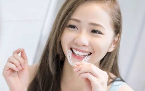 niềng răng Clear Aligner